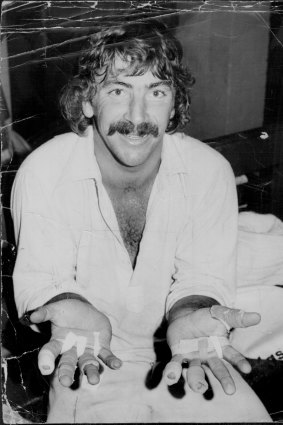 Rod Marsh displays the impact of keeping to Jeff Thomson and Dennis Lillee in January 1975.