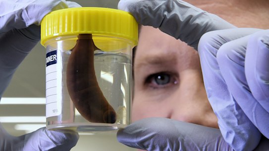 Kay Maddison, hand clinical nurse consultant at the hand clinic in Sydney Hospital. 