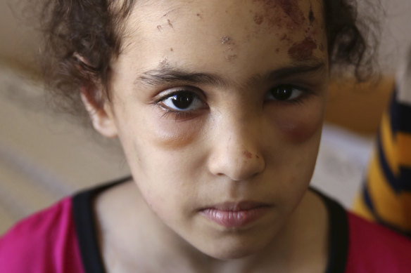 Suzy Ishkontana, 7, wept as her father spoke of her dreams of being a doctor when she grows up. 