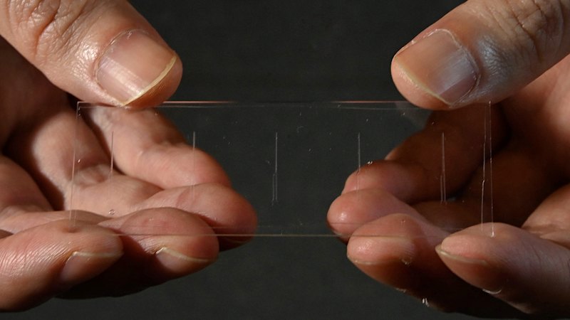 This tiny chip can predict your risk of stroke