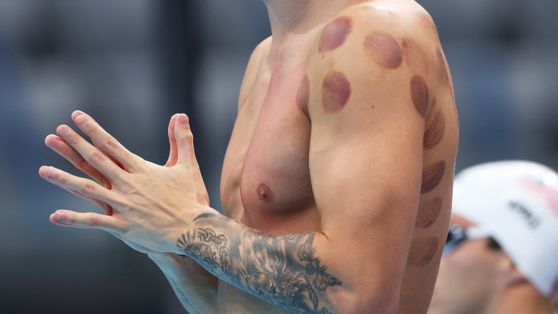 What are those red dots on Kyle Chalmers’ back?