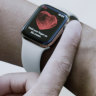 Why Australia needs heart health features on the local Apple Watch