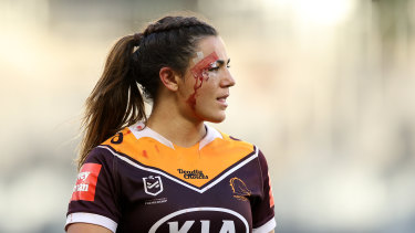 Millie Boyle Nrl . Millie Boyle Was About To Have Life Changing Surgery Then She Got A Call From Anthony Minichiello