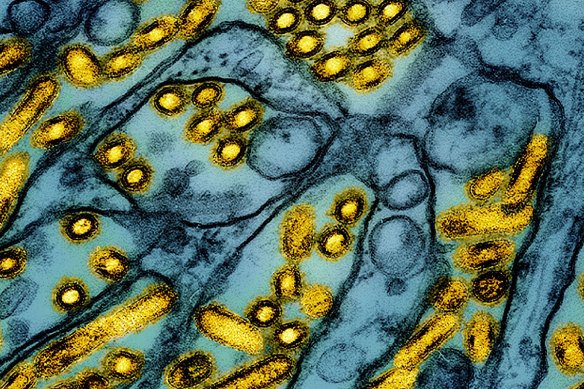 Particles of H5N1 bird flu flagged in yellow.