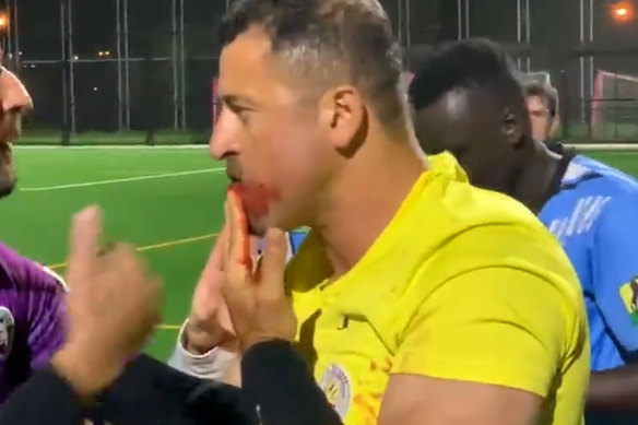 Referee Khodr Yaghi had his jaw broken in Friday night’s incident.