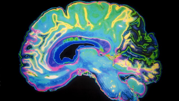 Donations of brain tissue led Australia scientists to make crucial discoveries that led the way for a new schizophrenia drug.