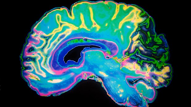 A new scan could detect Alzheimer’s earlier.