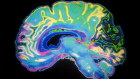 The study found evidence of people falling behind on their debts five years before diagnosis.