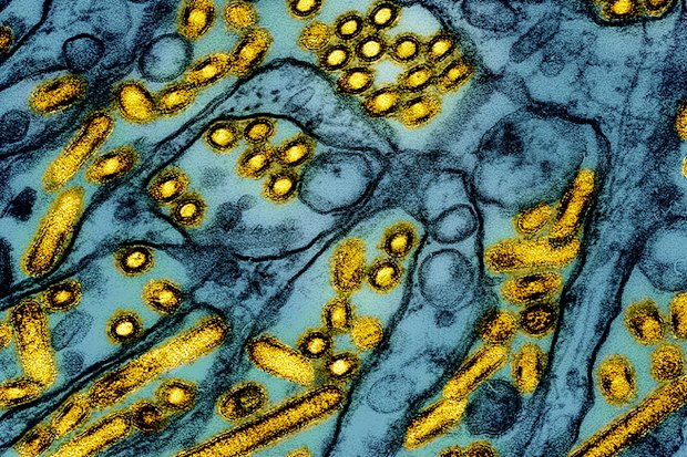 Hình ảnh hiển vi điện tử được tô màu của các hạt virus cúm gia cầm A H5N1.