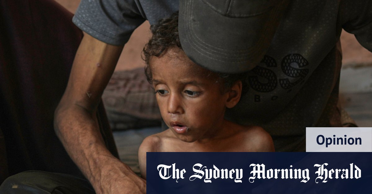 Israel must open its eyes: Defeating Hamas does not require starving a single child