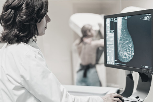 You will be invited to have a mammogram every two years once you turn 50. 