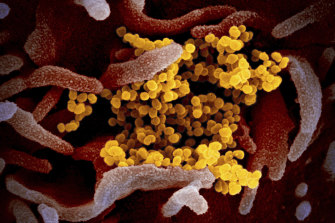 This undated electron microscope image made available by the US National Institutes of Health in February 2020 shows the Novel Coronavirus SARS-CoV-2, yellow, emerging from the surface of cells, pink, cultured in the lab. 