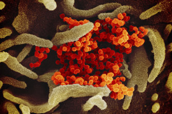 An electron microscope image shows SARS-CoV-2 (orange) emerging from the surface of cells (green) cultured in the lab. 