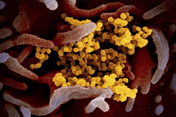 An electron microscope image shows the SARS-CoV-2 coronavirus (yellow) emerging from the surface of cells (pink) cultured in a US National Institutes of Health lab.