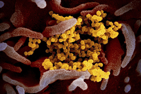 This undated electron microscope image made available by the US National Institutes of Health in February 2020 shows the Novel Coronavirus SARS-CoV-2, yellow, emerging from the surface of cells, pink, cultured in the lab. 