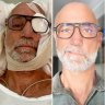A surfboard destroyed Graham’s face. Finding a surgeon wasn’t so easy