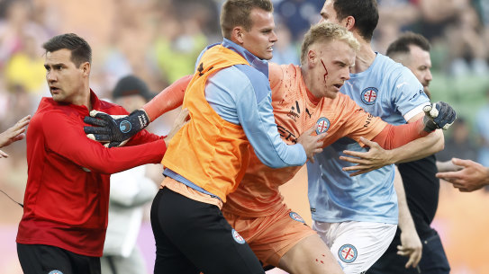 Melbourne City goalkeeper Tom Glover was left bleeding and concussed after fans stormed the pitch on December 17.
