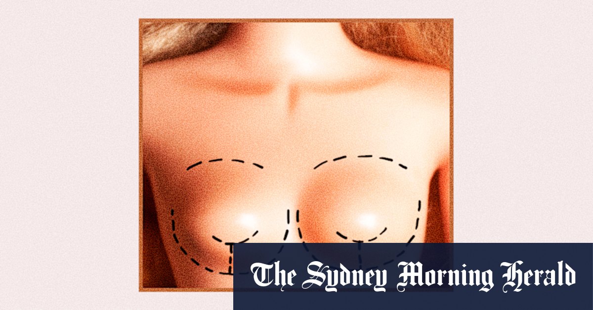 Implants getting smaller – it’s not a win for body acceptance