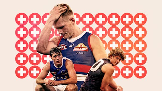 Injured AFL players George Wardlaw (North Melbourne), Adam Treloar (Western Bulldogs) and Charlie Curnow (Carlton).