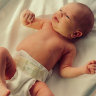 An increasing proportion of women are giving birth via caesarean. 