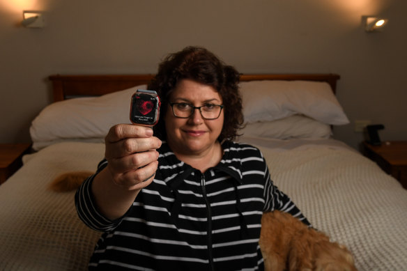 Kate Bendall credits her husband’s Apple Watch with discovering she was having an AFib.