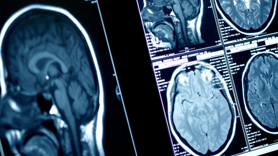 A woman has reportedly emerged from a 27-year coma.