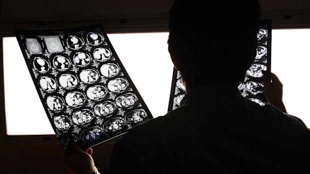 A Gold Coast doctor has been fined after he looked at his ex-wife’s medical scans without her permission.