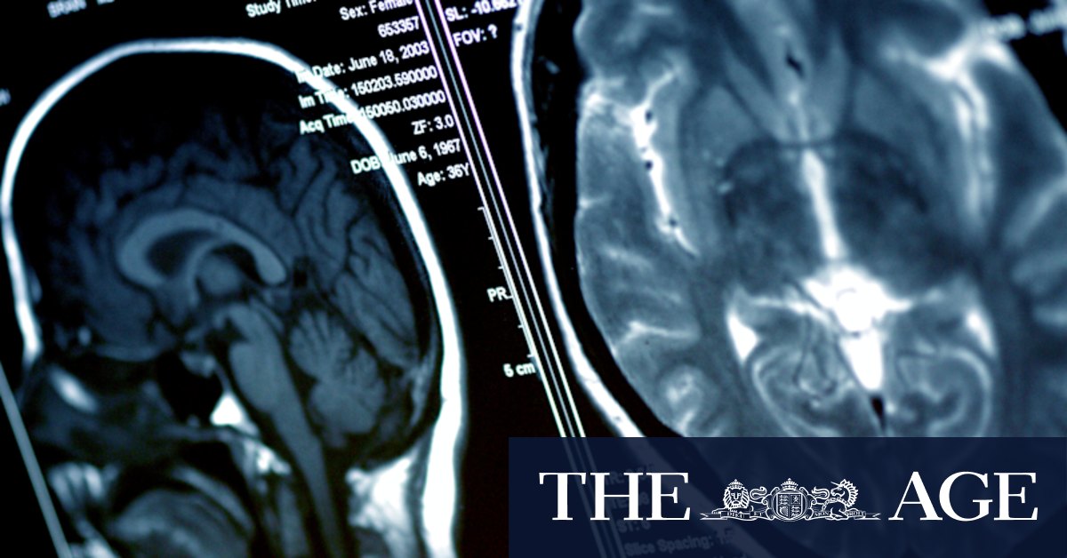 Non-medical staff operating on brains, spines after 'learning on the job' - Vimarsana News