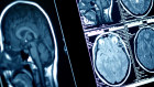 British private equity outfit Permira knows it’s in line for a $4 billion exit at radiology giant I-MED.