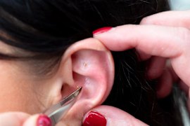 Ear seeding is all the rage on TikTok now, but does it actually do what its proponents claim?