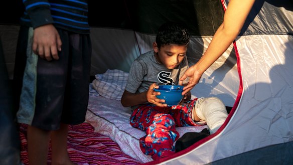 Angel, 10, who broke his left leg playing soccer and is treated by Dr Elisondo in a migrant camp in Matamoros, Mexico.