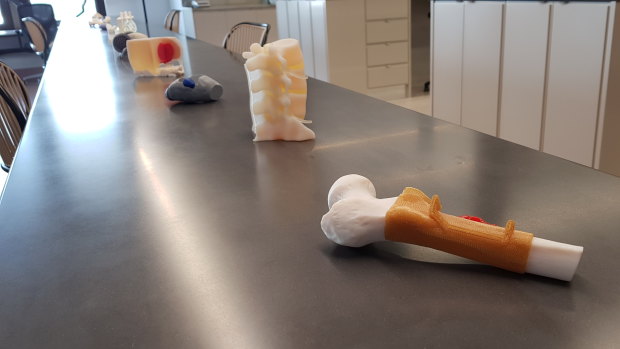 The 3D printers at the institute are capable of producing a range of items and implants.