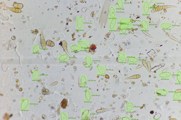 BioScout’s AI flags spores from a powdery mildew disease with green boxes.