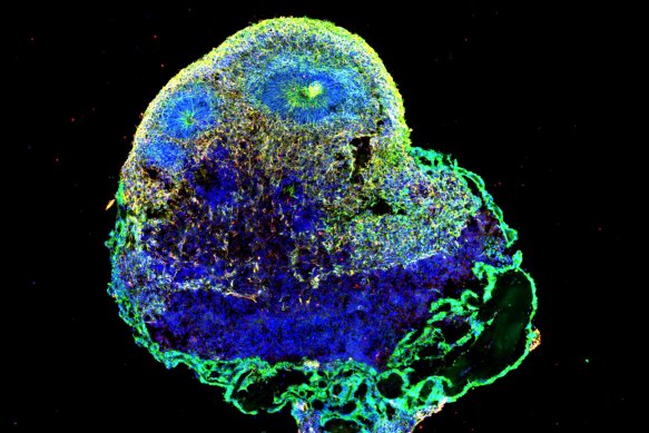 Another brain organoid through the microscope, created with stem cells.