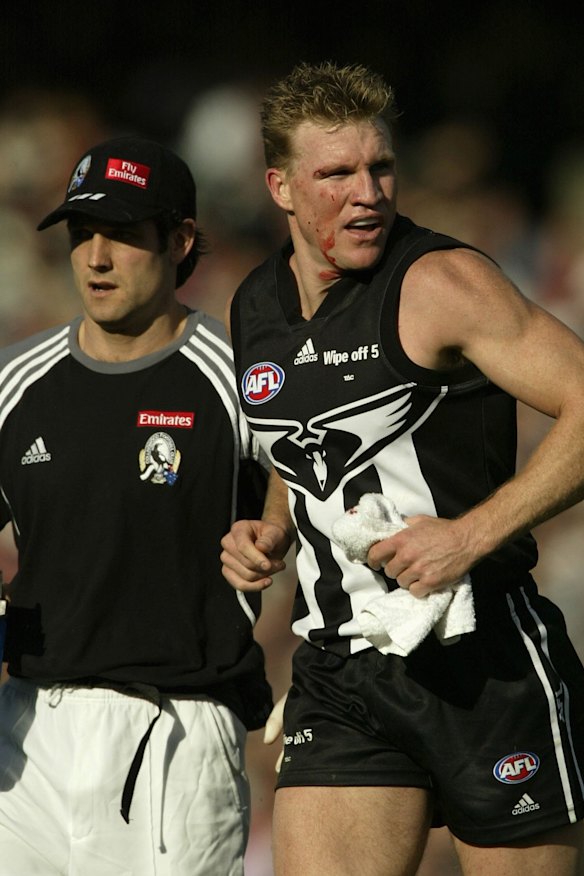 Nathan Buckley leaves the field bleeding in 2002.