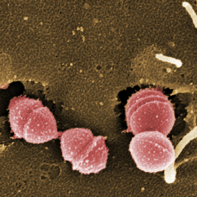 Because it is a bacteria, Strep A (pictured) can be treated with antibiotics, but there is not currently a vaccine against it.