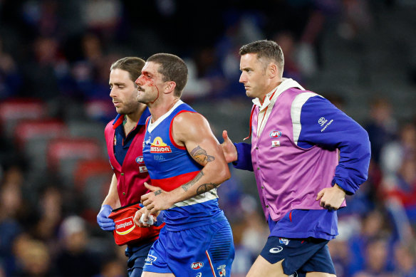 Tom Liberatore was ruled out of the game with concussion in the dying minutes of the match against Hawthorn.