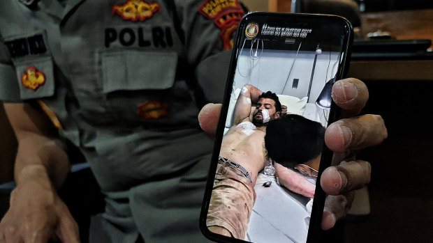 Kuta police show a photo of Nicholas Carr at Siloam Hospital.