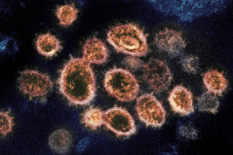 SARS-CoV-2 virus particles, which cause COVID-19.