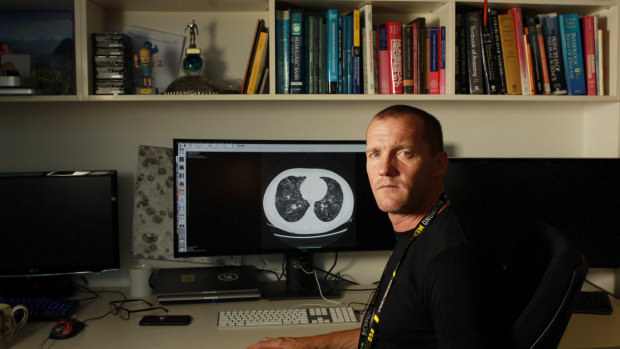 Professor Stuart Grieve, with a lung CT scan showing moderate COVID-19. He's the co-creator of a tool that will train doctors in diagnosing the disease from scans.