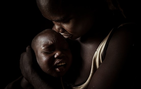 Teddy embraces her five-year-old son Moses as he winces in pain from the sores on the back of his head.