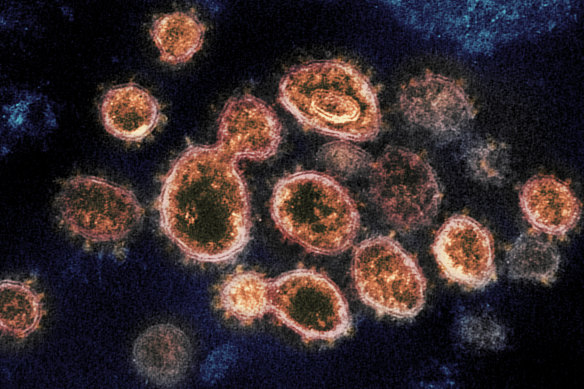 This 2020 electron microscope image provided by the National Institute of Allergy and Infectious Diseases - Rocky Mountain Laboratories shows SARS-CoV-2 virus particles which causes COVID-19, isolated from a patient in the U.S., emerging from the surface of cells cultured in a lab.