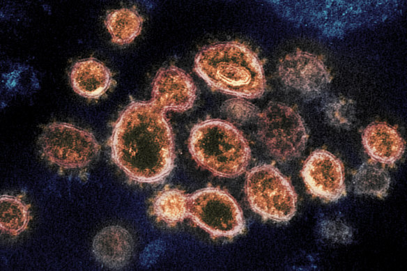 This electron microscope image provided by the US National Institute of Allergy and Infectious Diseases shows SARS-CoV-2 virus particles isolated from a patient, emerging from the surface of cells cultured in a lab.