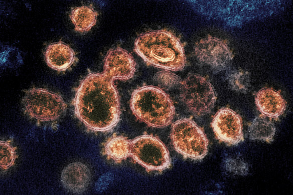 SARS-CoV-2 virus particles which cause COVID-19.