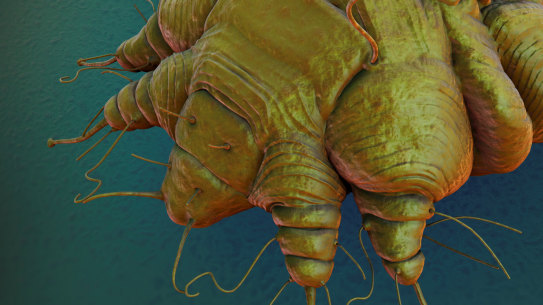 A close-up view of the cause of scabies: the Sarcoptes scabiei mite.