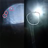 X-Rays that show the medical condition of Hodan Abby’s nine-year-old daughter. 