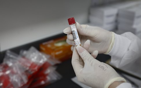 The federal government will give two of the companies making the COVID-19 vaccine indemnity against prosecution.