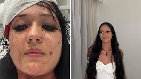 Zoe Samson-Wood was allegedly attacked by a co-worker now accused of stalking and attempted murder.