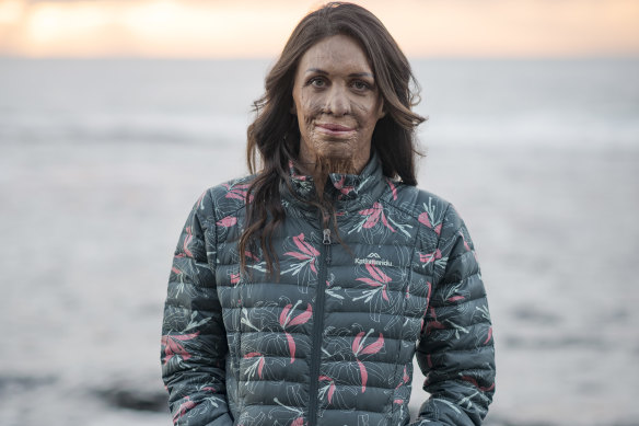 Turia Pitt: “I was suddenly overwhelmed by feelings of love and gratitude for you.”