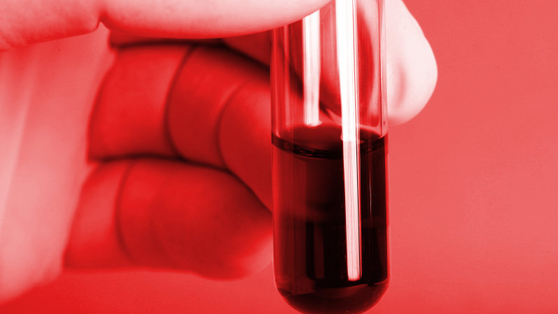 Csl Partners With Us Clinical Stage Biotech